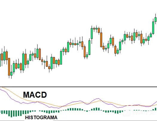 MACD MACD