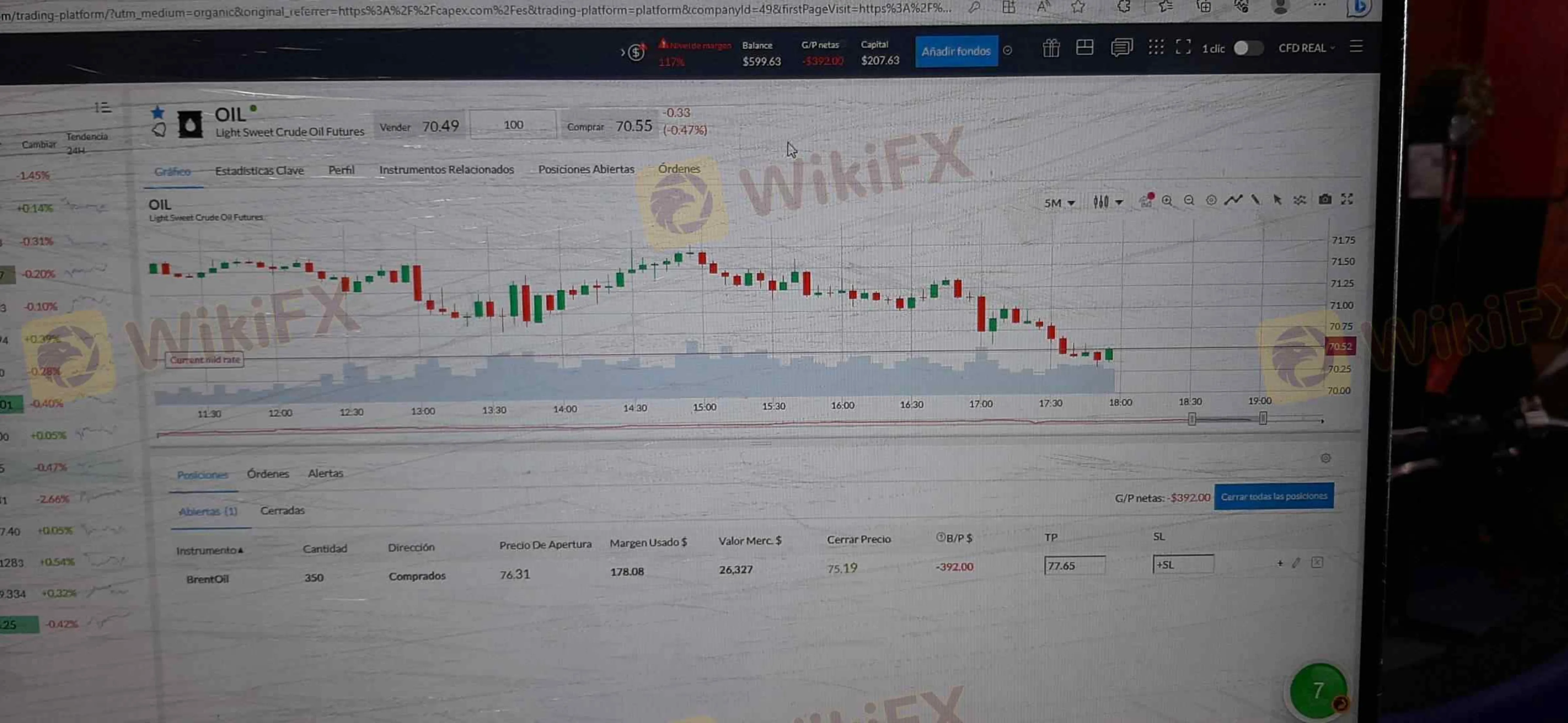 Capex Capex