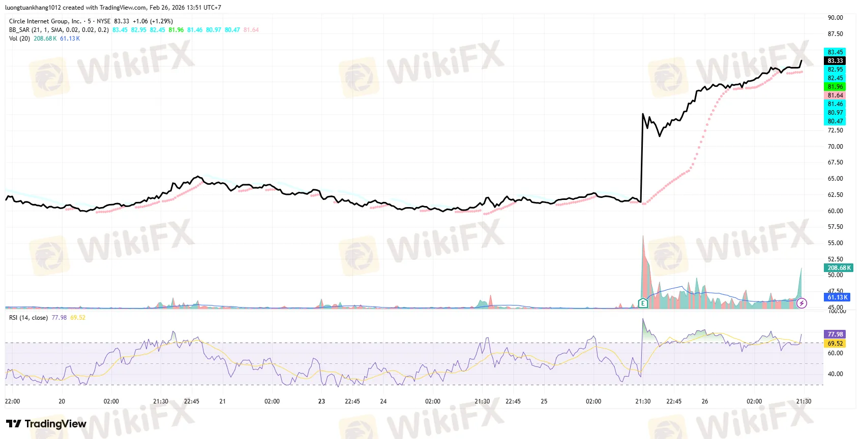 CRCL_2026-02-26_13-51-00.png CRCL_2026-02-26_13-51-00.png